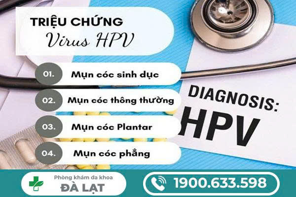 Hình ảnh minh họa